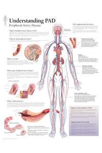 Understanding PAD Paper Poster
