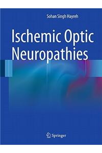 Ischemic Optic Neuropathies
