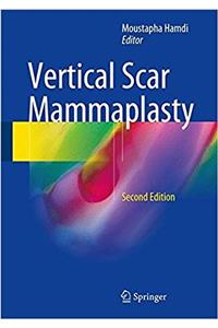 Vertical Scar Mammaplasty