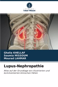 Lupus-Nephropathie