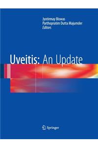 Uveitis