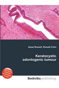 Keratocystic Odontogenic Tumour