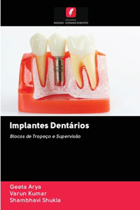 Implantes Dentários