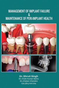 Management of Implant Failure & Maintenance of Peri-Implant Health