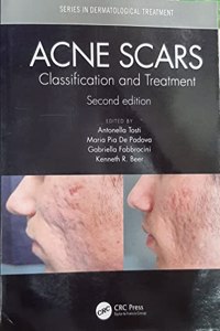 ACNE SCARS