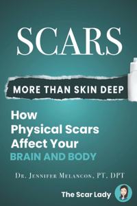 Scars