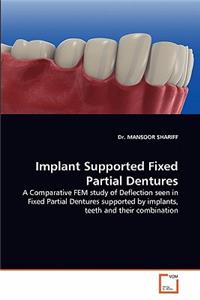 Implant Supported Fixed Partial Dentures