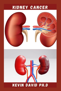 Kidney Cancer