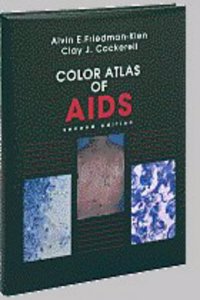 Color Atlas Of Aids : 2 /E