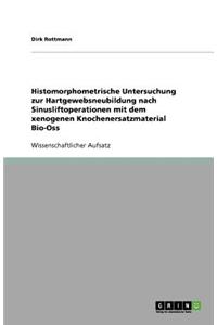 Histomorphometrische Untersuchung zur Hartgewebsneubildung nach Sinusliftoperationen mit dem xenogenen Knochenersatzmaterial Bio-Oss