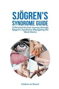 Sjögren's Syndrome Guide