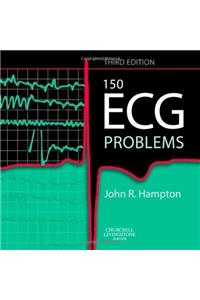 150 Ecg Problems