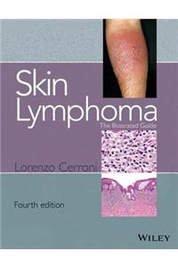 Skin Lymphoma