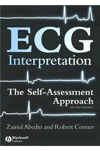 ECG Interpretation