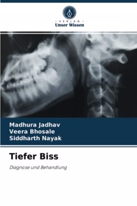 Tiefer Biss