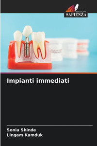 Impianti immediati