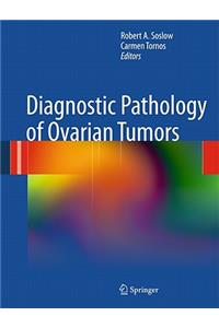 Diagnostic Pathology of Ovarian Tumors