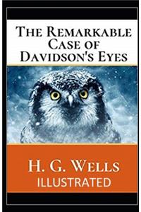 The Remarkable Case of Davidson's Eyes Illustrated