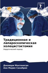 Традиционная и лапароскопическая холец