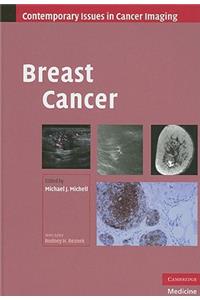 Breast Cancer