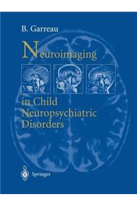 Neuroimaging in Child Neuropsychiatric Disorders
