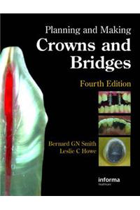 Planning and Making Crowns and Bridges