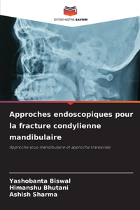 Approches endoscopiques pour la fracture condylienne mandibulaire