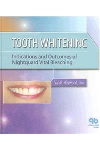 Tooth Whitening: Indications and Outcomes of Nightguard Vital Bleaching