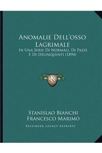 Anomalie Dell'osso Lagrimale