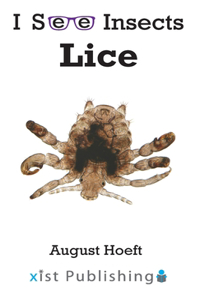 Lice