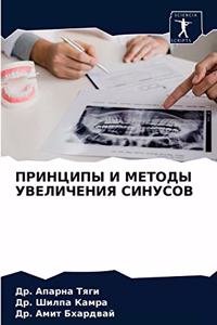 ПРИНЦИПЫ И МЕТОДЫ УВЕЛИЧЕНИЯ СИНУСОВ