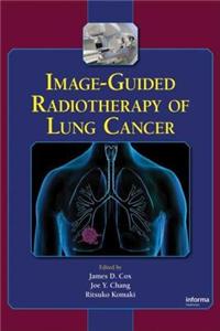 Image-Guided Radiotherapy of Lung Cancer