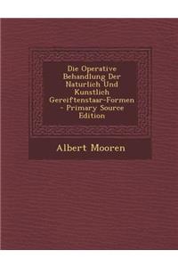 Operative Behandlung Der Naturlich Und Kunstlich Gereiftenstaar-Formen