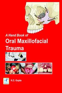 A Hand Book of Oral Maxillofacial Trauma