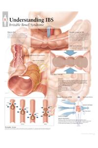 Understanding IBS Paper Poster