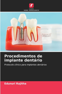 Procedimentos de implante dentário