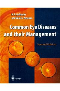 Common Eye Diseases and Their Management