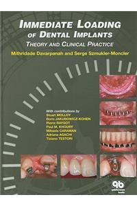 Immediate Loading of Dental Implants: Theory and Clinical Practice