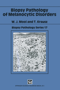 Biopsy Pathology of Melanocytic Disorders