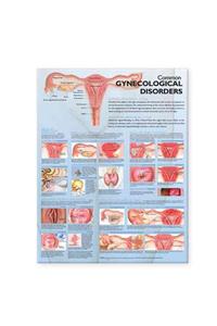 Common Gynecological Disorders Anatomical Chart