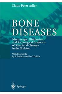 Bone Diseases