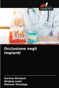 Occlusione negli impianti