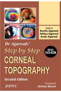Dr Agarwal's Step by Step (R) Corneal Topography