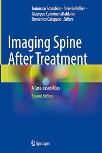 Imaging Spine After Treatment