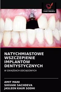 Natychmiastowe Wszczepienie Implantów Dentystycznych