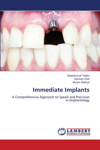 Immediate Implants