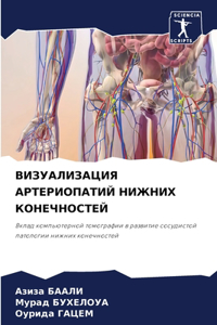 ВИЗУАЛИЗАЦИЯ АРТЕРИОПАТИЙ НИЖНИХ КОНЕЧН&
