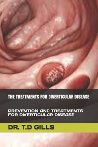 Treatments for Diverticular Disease