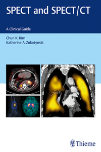 Spect and Spect/CT