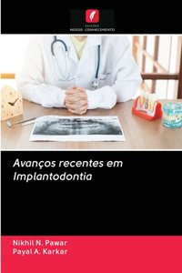 Avanços recentes em Implantodontia